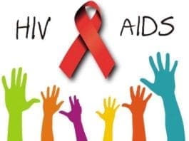 HIV -AIDS