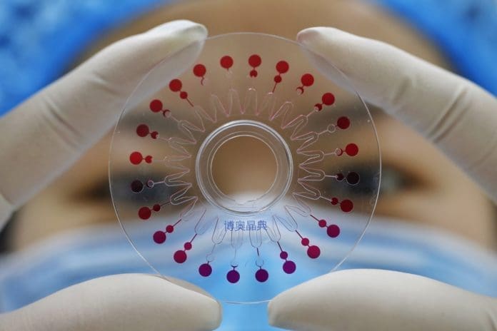 A researcher of CapitalBio Corporation shows a virus nucleic acid detection kit for six respiratory pathogens on March 10. Six respiratory pathogens, including the COVID-19, can be detected simultaneously within one and a half hours, requiring samples of only respiratory droplets. (Photo by Jiang Wenjie, People’s Daily Online)