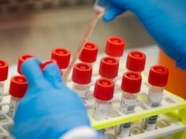 Coronavirus Test Kits