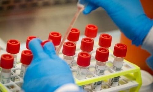Coronavirus Test Kits