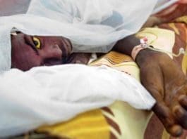 Cerebrospinal Meningitis (CSM)