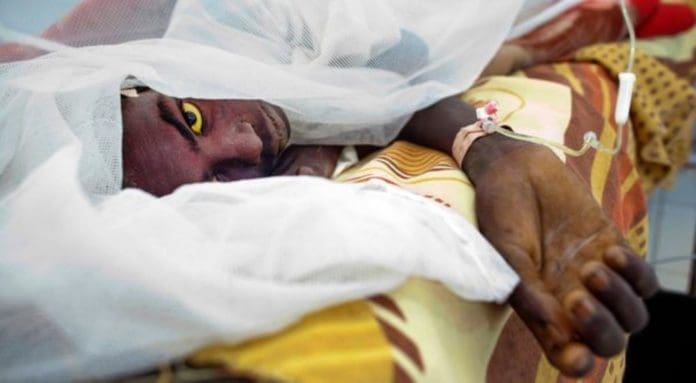 Cerebrospinal Meningitis (CSM)
