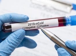 Covid Positive