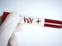 Hiv Aids Seroconversion Time Thumb