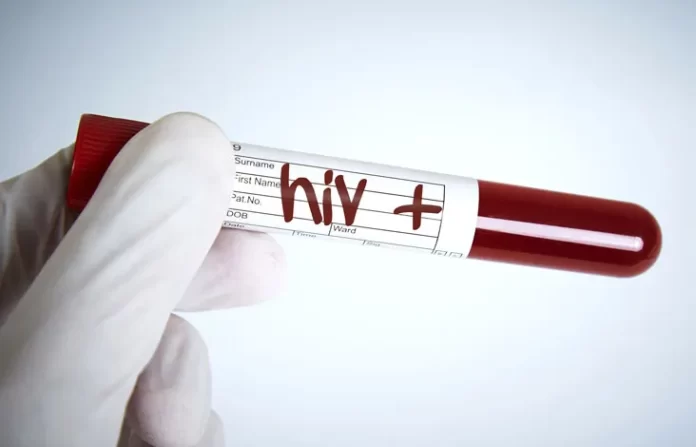 Hiv Aids Seroconversion Time Thumb