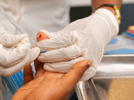 © UNICEF/Rindra Ramasomanana – A mother-to-be is tested for HIV in Analanjirofo Region, Madagascar.