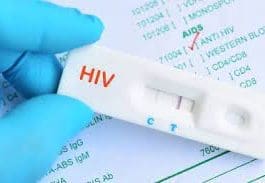 HIV