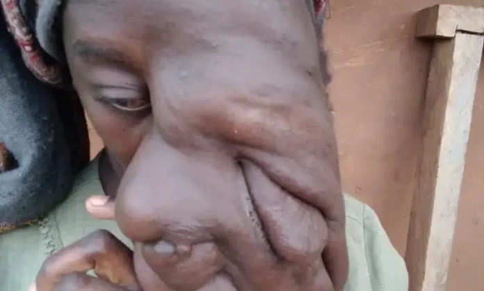 Rare Condition