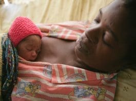 Mother Practicing Kangaroo Mother Care Kmc At Bwaila Hospital In Lilongwe Malawi Credit Frederic Courbet
